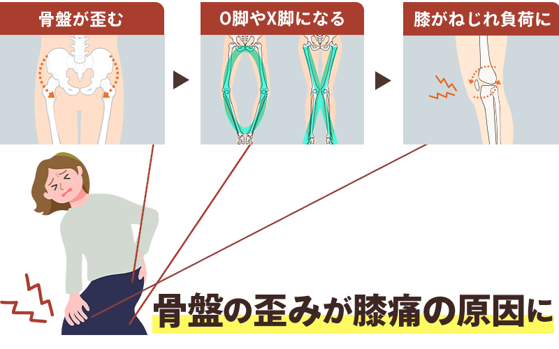膝痛が生じる流れイメージ