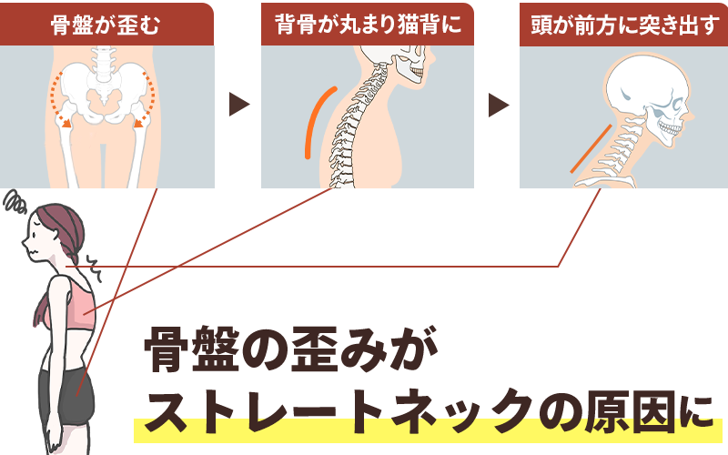 ストレートネックが生じる流れイメージ